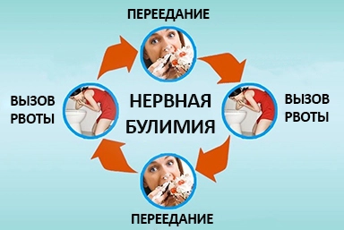 Лечение булимии в Какашуре